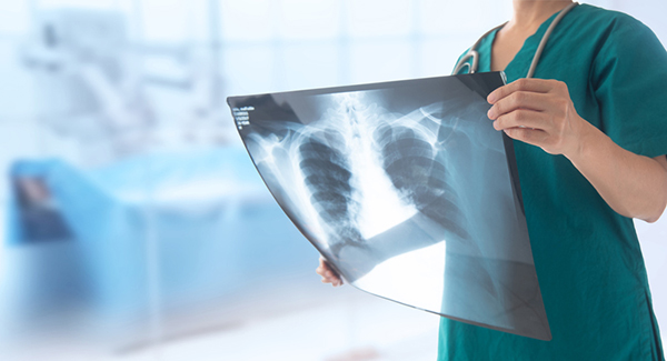  radiologist looking lung x-ray film of patient at hospital